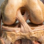 Arka Çapraz Bağ (PCL) Yaralanmaları ve Artroskopik Tedavi Yaklaşımı